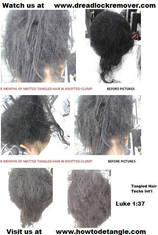 Hair loss is Real- So Save Your Matted Hair
