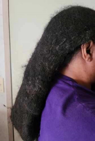 Matted Hair Models Wanted-New TV Series Casting Uncombable/Extreme Knotty/Matted/Locked Up Hair