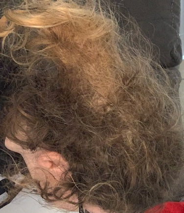 The Harsh Truth About Matted Hair