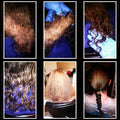 Mobile Detangle Services With 2 Tangle Hair Experts for Extremely Matted Hair